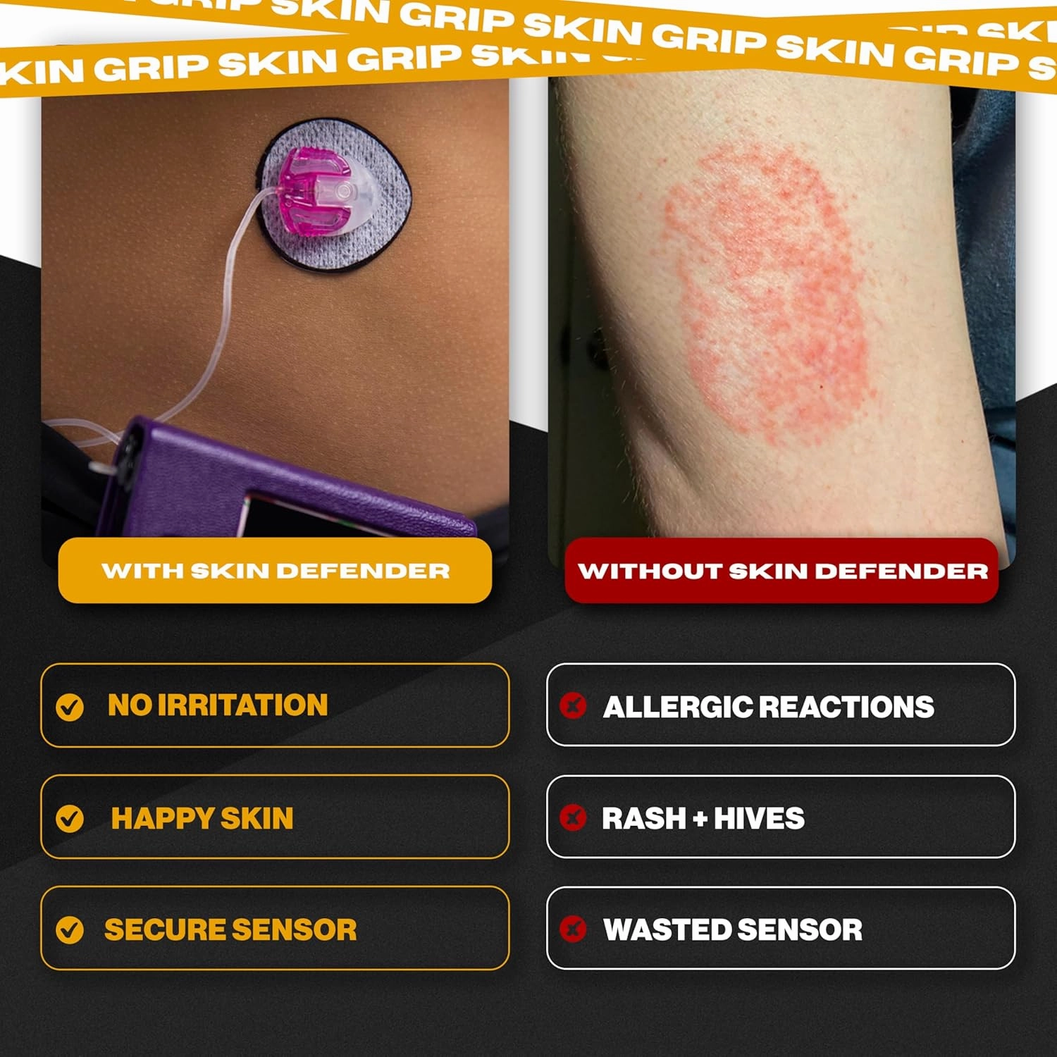 Skin Grip: Skin Defender Reusable Barrier for Infusion Sets – Pre-Cut, Non-Adhesive Cover for Insulin Pumps – Layer Helps Prevent Allergic Reactions – 5 Pack